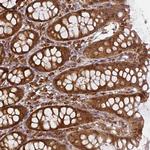 PPP6R3 Antibody in Immunohistochemistry (Paraffin) (IHC (P))