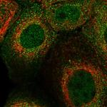SNX22 Polyclonal Antibody