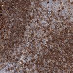 SNX22 Antibody in Immunohistochemistry (Paraffin) (IHC (P))