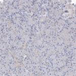 RCN1 Antibody in Immunohistochemistry (IHC)