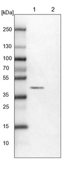 RCN1 Antibody in Western Blot (WB)