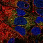 PSAPL1 Polyclonal Antibody