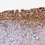 Cerebral Protein 1 Antibody in Immunohistochemistry (Paraffin) (IHC (P))
