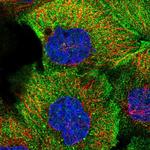 TMEM218 Polyclonal Antibody