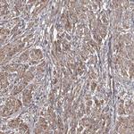 TMEM218 Antibody in Immunohistochemistry (IHC)