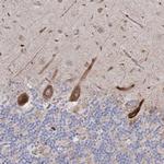 NHLRC2 Antibody in Immunohistochemistry (Paraffin) (IHC (P))