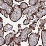 NHLRC2 Polyclonal Antibody