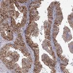 NHLRC2 Antibody in Immunohistochemistry (Paraffin) (IHC (P))