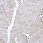 NHLRC2 Antibody in Immunohistochemistry (Paraffin) (IHC (P))