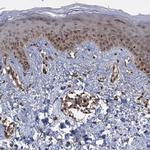 C12orf41 Antibody in Immunohistochemistry (IHC)