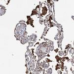 OTUD1 Antibody in Immunohistochemistry (IHC)