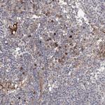 OTUD1 Antibody in Immunohistochemistry (IHC)