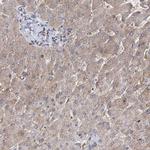OTUD1 Antibody in Immunohistochemistry (IHC)