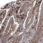 OTUD1 Antibody in Immunohistochemistry (IHC)