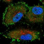 TTC17 Antibody in Immunocytochemistry (ICC/IF)