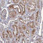 TTC17 Antibody in Immunohistochemistry (Paraffin) (IHC (P))