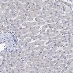 PPRC1 Antibody in Immunohistochemistry (Paraffin) (IHC (P))