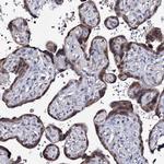 PPRC1 Antibody in Immunohistochemistry (Paraffin) (IHC (P))