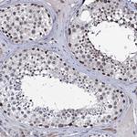 PPRC1 Antibody in Immunohistochemistry (Paraffin) (IHC (P))