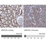 MRPS35 Antibody in Immunohistochemistry (IHC)
