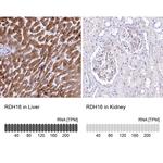 RDH16 Polyclonal Antibody