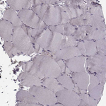 WDR63 Antibody in Immunohistochemistry (Paraffin) (IHC (P))