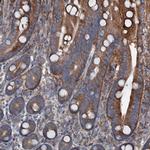 DDIAS Antibody in Immunohistochemistry (Paraffin) (IHC (P))