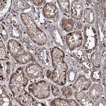 DDIAS Antibody in Immunohistochemistry (Paraffin) (IHC (P))