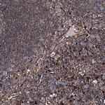 DDIAS Antibody in Immunohistochemistry (Paraffin) (IHC (P))