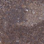 DDIAS Antibody in Immunohistochemistry (IHC)