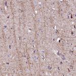 FCHSD2 Antibody in Immunohistochemistry (Paraffin) (IHC (P))