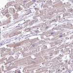 FCHSD2 Antibody in Immunohistochemistry (Paraffin) (IHC (P))