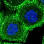 FCHSD2 Polyclonal Antibody