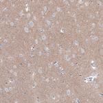 FCHSD2 Antibody in Immunohistochemistry (IHC)