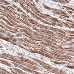 FCHSD2 Antibody in Immunohistochemistry (IHC)