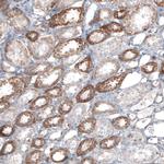 FCHSD2 Antibody in Immunohistochemistry (IHC)