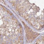 HAL Antibody in Immunohistochemistry (IHC)