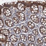 TMTC3 Polyclonal Antibody