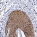 C2CD3 Polyclonal Antibody