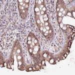 TAP26 Antibody in Immunohistochemistry (Paraffin) (IHC (P))