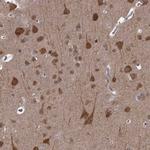 CCDC92 Polyclonal Antibody