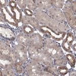 CCDC92 Antibody in Immunohistochemistry (Paraffin) (IHC (P))
