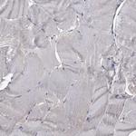 CCDC92 Antibody in Immunohistochemistry (Paraffin) (IHC (P))