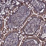 CCDC92 Antibody in Immunohistochemistry (Paraffin) (IHC (P))