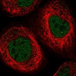 ELP4 Polyclonal Antibody