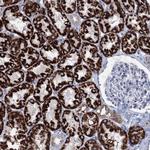 ELP4 Antibody in Immunohistochemistry (Paraffin) (IHC (P))