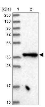 ELP4 Antibody in Western Blot (WB)