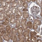 ELP4 Polyclonal Antibody