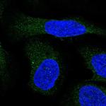 ALG9 Polyclonal Antibody