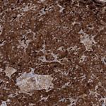ALG9 Antibody in Immunohistochemistry (Paraffin) (IHC (P))